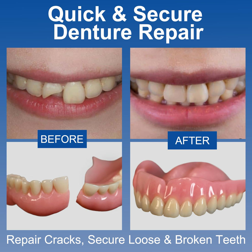 1 oz Clear Dental Bonding Glue U44710